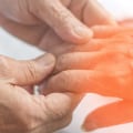 Will neuropathy get worse?