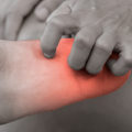 What are the final stages of neuropathy?