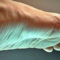What causes neuropathy in the feet at night?