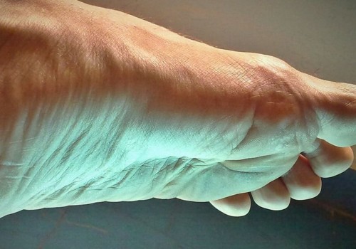 How do you get rid of neuropathy on the feet at night?