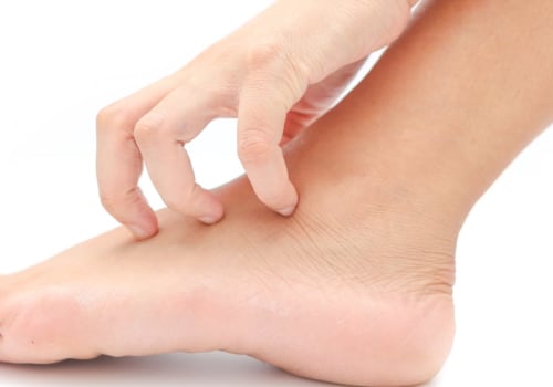 Is neuropathy of the feet reversible?