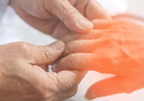 When does neuropathy worsen?